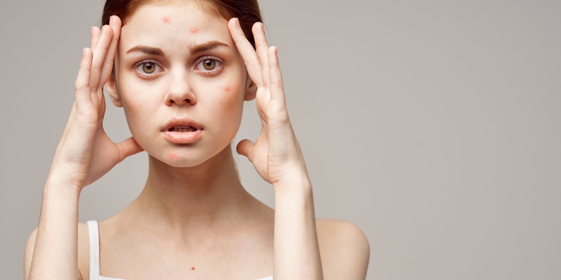 Clear Skin Diet: Nourishing Your Way to an Acne-Free Complexion